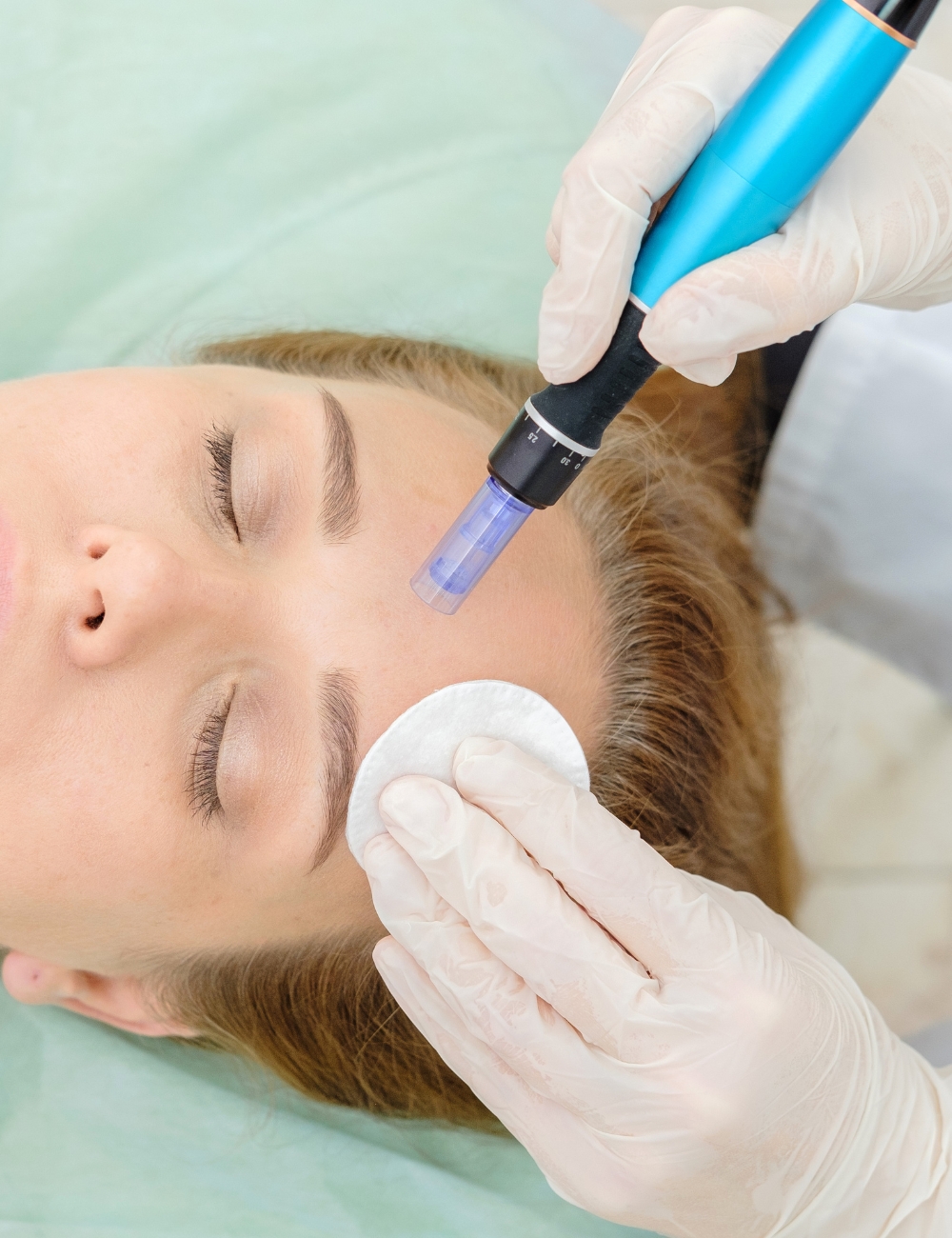 Microneedling-behandling i klinikken